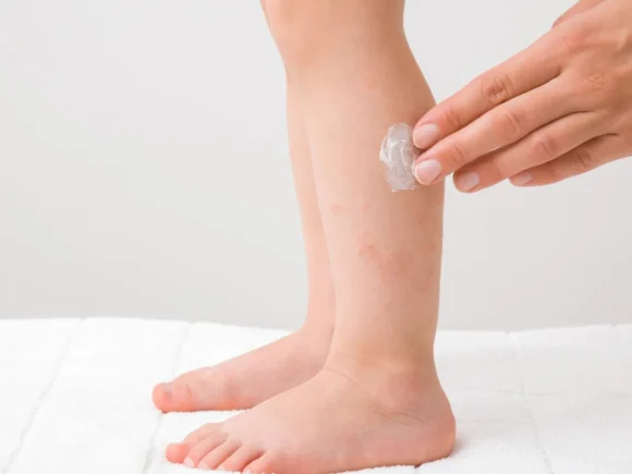 حساسية الصيف عند الاطفال : كيف تساعد أطفالك على التعامل مع أعراض الحساسية